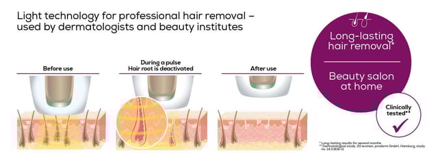 IPL Velvet Skin Pro 300000 Hair Remover Device