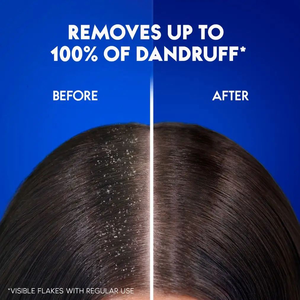 Head & Shoulders Classic Clean Anti-Dandruff Shampoo, 600 ml