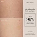SmoothSkin Pure Fit IPL Hair Removal Device