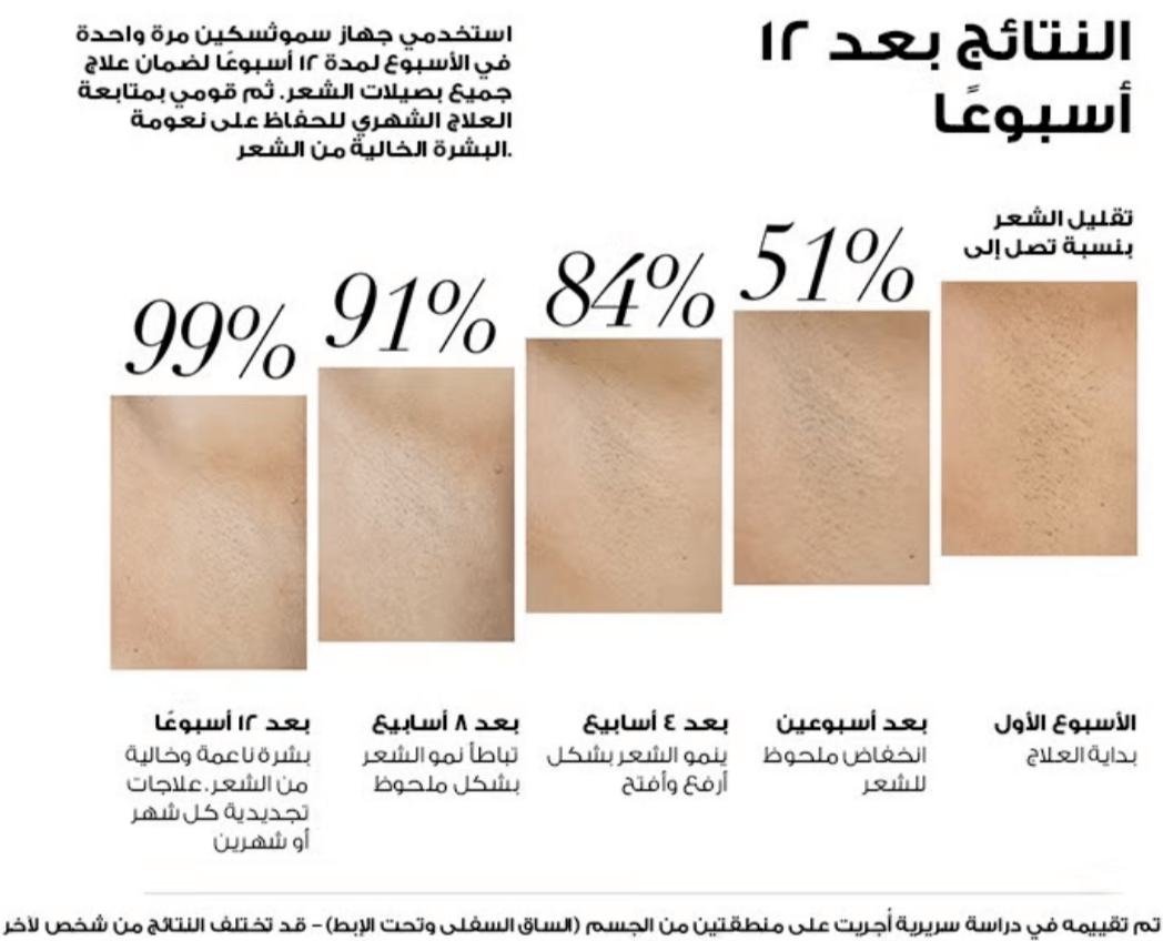 SmoothSkin Pure Fit IPL Hair Removal Device